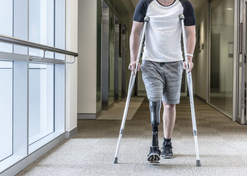 Psychophysiology treatments: Using biofeedback therapy to treat phantom limb pain